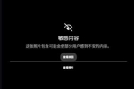 😱露骨！慎入！范德彪小拇指的骨头直接刺出来了！
